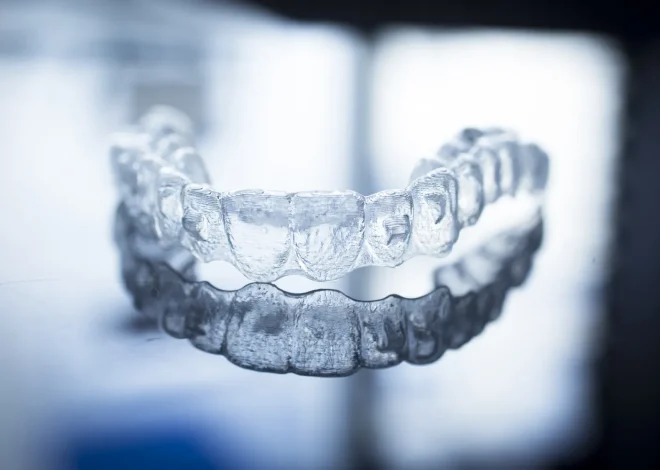 Nakładki Invisalign Lublin